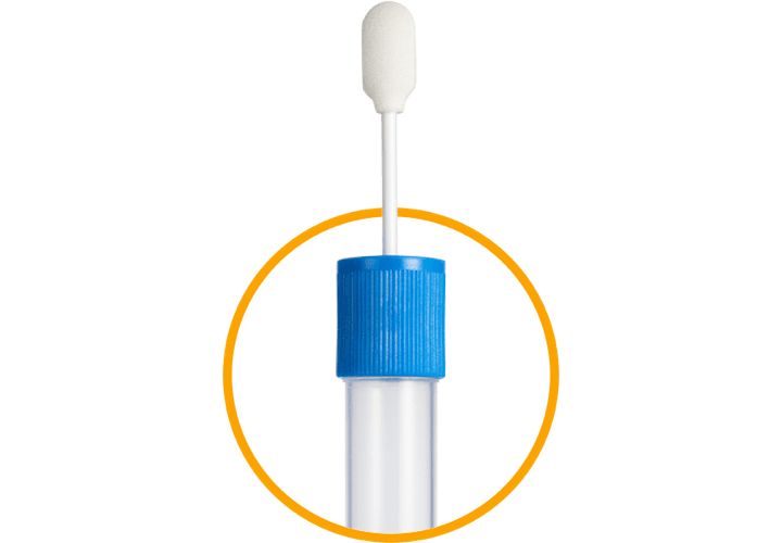 AlphaID genetic screening test that detects the 14 most prevalent alleles associated with AAT deficiency
